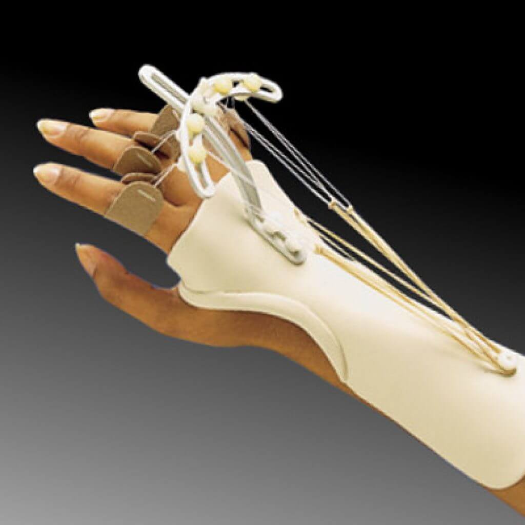 Tutore dinamico per la lesione del nervo radiale della mano
